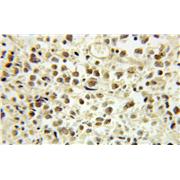 E2F4 Rabbit Polyclonal Antibody (10923-1-AP)