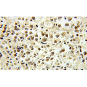 E2F4 Rabbit Polyclonal Antibody (10923-1-AP)