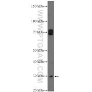 SAT1 Rabbit Polyclonal Antibody (10708-1-AP)