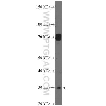SAT1 Rabbit Polyclonal Antibody (10708-1-AP)