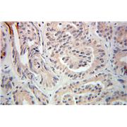 TRIM9 Rabbit Polyclonal Antibody (10786-1-AP)
