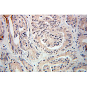 TRIM9 Rabbit Polyclonal Antibody (10786-1-AP)