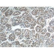 RAB23 Rabbit Polyclonal Antibody (11101-1-AP)