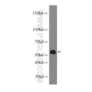 COX10 Rabbit Polyclonal Antibody (10611-2-AP)