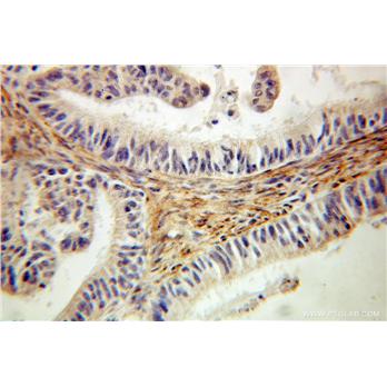 EMILIN1 Rabbit Polyclonal Antibody (10643-1-AP)