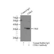 CDK4 Rabbit Polyclonal Antibody (11026-1-AP)