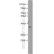 RAB33A Rabbit Polyclonal Antibody (11025-1-AP)