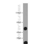 EIF3E Rabbit Polyclonal Antibody (10899-1-AP)