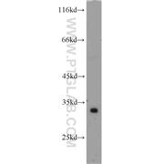 ATP5C1 Rabbit Polyclonal Antibody (10910-1-AP)