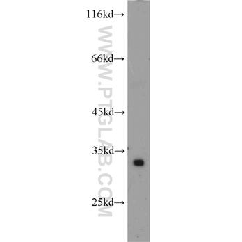 ATP5C1 Rabbit Polyclonal Antibody (10910-1-AP)
