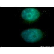 NFE2 Rabbit Polyclonal Antibody (11089-1-AP)