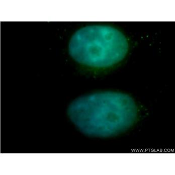 NFE2 Rabbit Polyclonal Antibody (11089-1-AP)