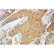 PRKCZ Rabbit Polyclonal Antibody (10860-1-AP)