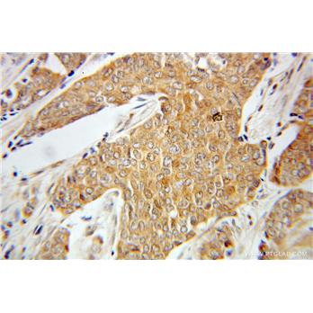 PRKCZ Rabbit Polyclonal Antibody (10860-1-AP)