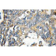 FHL1 Rabbit Polyclonal Antibody (10991-1-AP)
