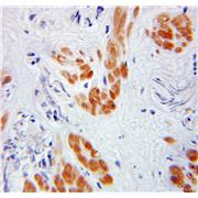 TADA3L Rabbit Polyclonal Antibody (10839-1-AP)