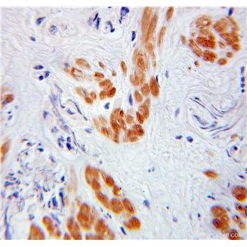 TADA3L Rabbit Polyclonal Antibody (10839-1-AP)