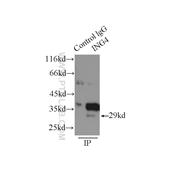 ING4 Rabbit Polyclonal Antibody (10617-1-AP)