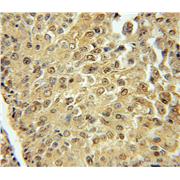 ARHGEF10 Rabbit Polyclonal Antibody (11112-1-AP)