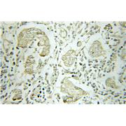 B4GALT3 Rabbit Polyclonal Antibody (11041-1-AP)