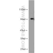 TDP1 Rabbit Polyclonal Antibody (10641-1-AP)