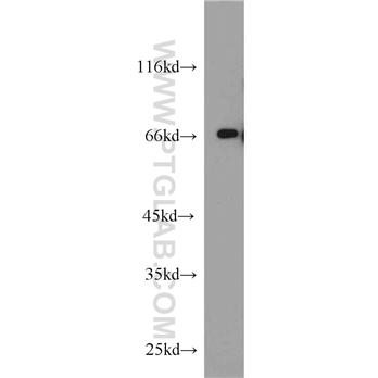 TDP1 Rabbit Polyclonal Antibody (10641-1-AP)