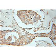 FGFR4 Rabbit Polyclonal Antibody (11098-1-AP)