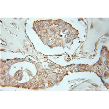FGFR4 Rabbit Polyclonal Antibody (11098-1-AP)