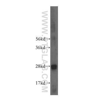 RAB32 Rabbit Polyclonal Antibody (10999-1-AP)