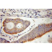 TIMM10 Rabbit Polyclonal Antibody (11124-2-AP)