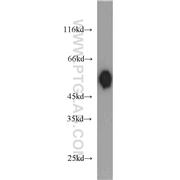 DLK1 Rabbit Polyclonal Antibody (10636-1-AP)