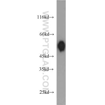 DLK1 Rabbit Polyclonal Antibody (10636-1-AP)