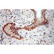 PGM2 Rabbit Polyclonal Antibody (11022-1-AP)