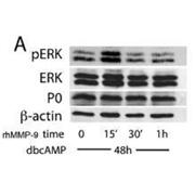 MPZ Rabbit Polyclonal Antibody (10572-1-AP)