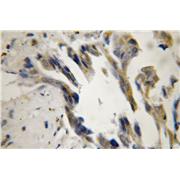DNAJA3 Rabbit Polyclonal Antibody (11088-1-AP)