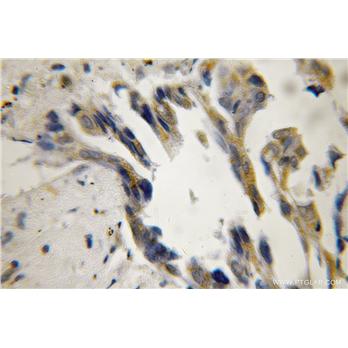DNAJA3 Rabbit Polyclonal Antibody (11088-1-AP)