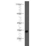 FHL3 Rabbit Polyclonal Antibody (11028-2-AP)
