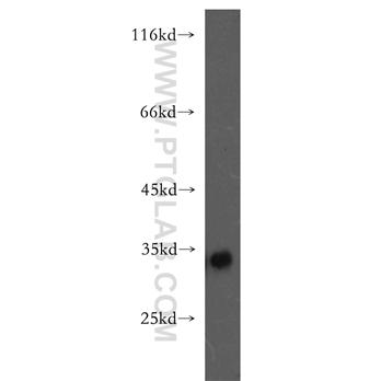 FHL3 Rabbit Polyclonal Antibody (11028-2-AP)
