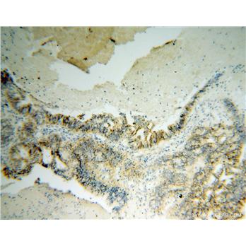 SDC1 Rabbit Polyclonal Antibody (10593-1-AP)