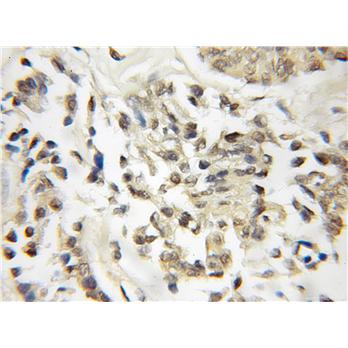 DOM3Z Rabbit Polyclonal Antibody (11015-2-AP)