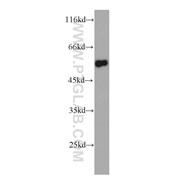 TRIM11 Rabbit Polyclonal Antibody (10851-1-AP)