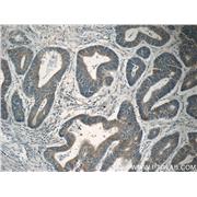 MDK Rabbit Polyclonal Antibody (11009-1-AP)