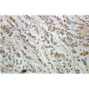 ING5 Rabbit Polyclonal Antibody (10665-1-AP)