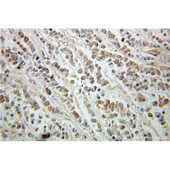 ING5 Rabbit Polyclonal Antibody (10665-1-AP)