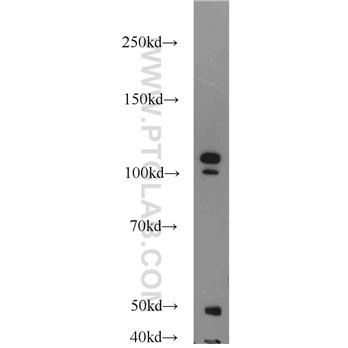 NCL Rabbit Polyclonal Antibody (10556-1-AP)