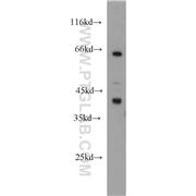GLUL Rabbit Polyclonal Antibody (11037-2-AP)