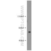 PPAN Rabbit Polyclonal Antibody (11006-1-AP)