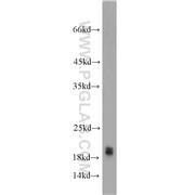 SNCA Rabbit Polyclonal Antibody (10842-1-AP)
