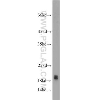 SNCA Rabbit Polyclonal Antibody (10842-1-AP)