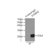 STMN2 Rabbit Polyclonal Antibody (10586-1-AP)